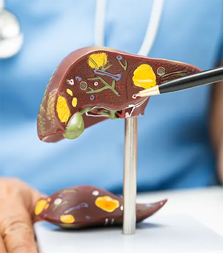 Plan Higado Graso, Dieta médica, plan personalizado