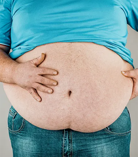 Plan Sobrepeso, Dieta médica, plan personalizado